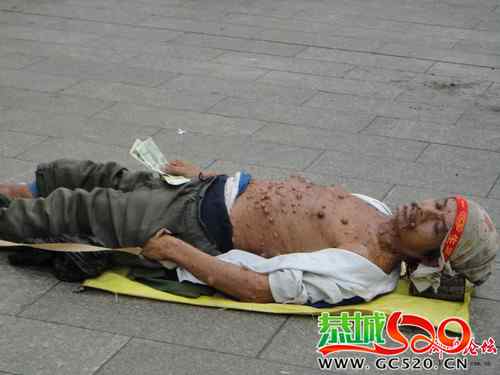 中外乞丐的各种差异、、735 / 作者:九姑娘 / 帖子ID:332