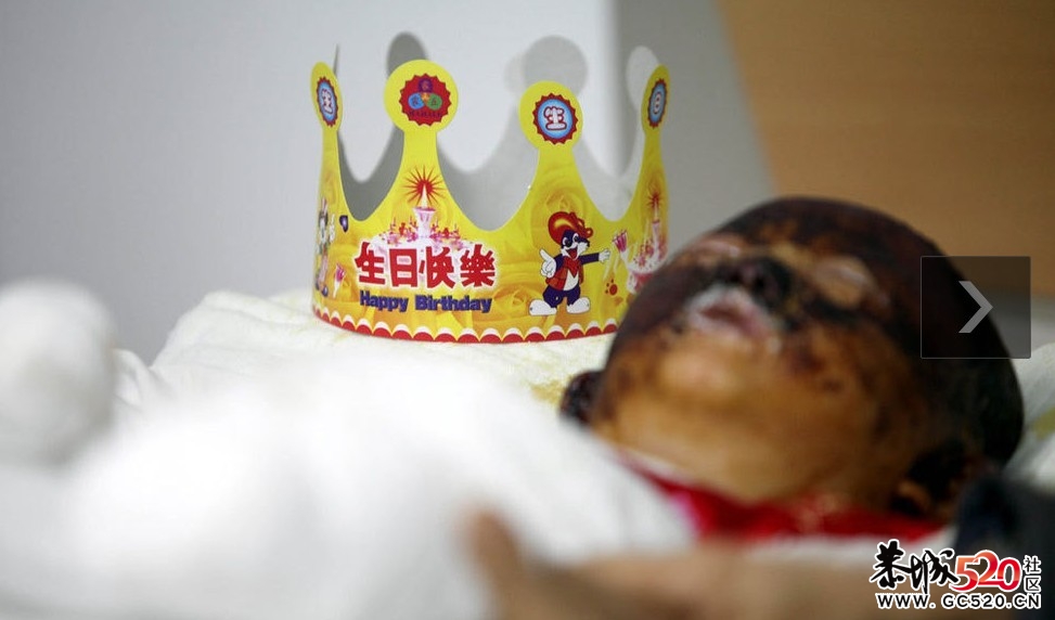 俗话说虎毒不食子 可却偏偏向亲生女儿下手！男子不同意离婚浇汽油烧女儿354 / 作者:小雨点 / 帖子ID:4580