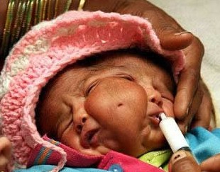 合肥孕妇B超发现罕见“双面”胎儿“图”734 / 作者:极速6688 / 帖子ID:11214