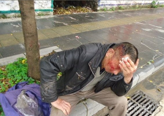 车祸,场面血腥.胆小勿入!!!189 / 作者:穷人 / 帖子ID:13683