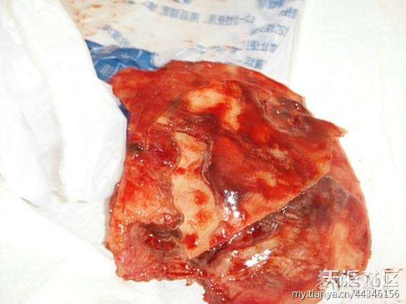 [桂林阳朔]农民工讨薪被打成植物人，救救我的父亲，谁能为我家主持公道？384 / 作者:受伤的燕子 / 帖子ID:14027