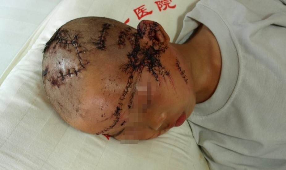 江西8岁留守童被母亲砍20多刀517 / 作者:小雨点 / 帖子ID:19212