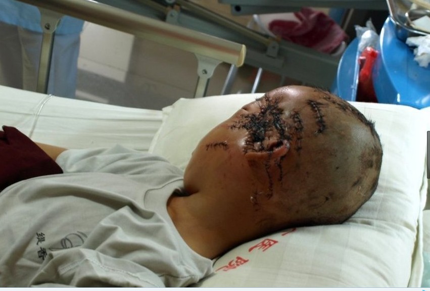 江西8岁留守童被母亲砍20多刀935 / 作者:小雨点 / 帖子ID:19212