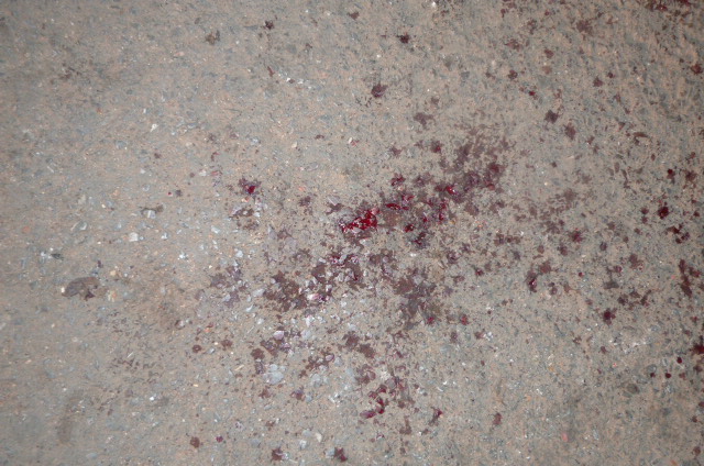 加会宵夜摊刀拼后现场199 / 作者:咖啡羊 / 帖子ID:48478