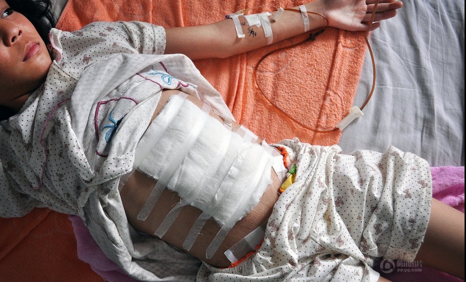 湖南小学女生遭同学围殴 脾脏破裂被摘除355 / 作者:小雨点 / 帖子ID:68263