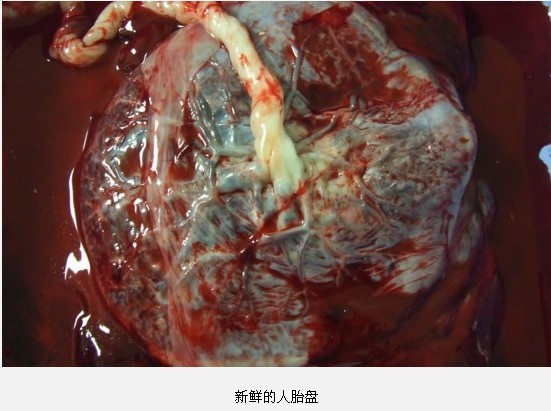 全球最惊悚的20大重口味&quot;美食&quot;226 / 作者:麻蛋 / 帖子ID:91682