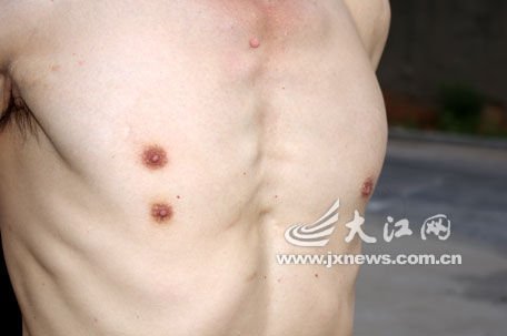 你见过长三个乳头的男子吗? 医生称男女均可能发生142 / 作者:龍虎袍哥 / 帖子ID:95985