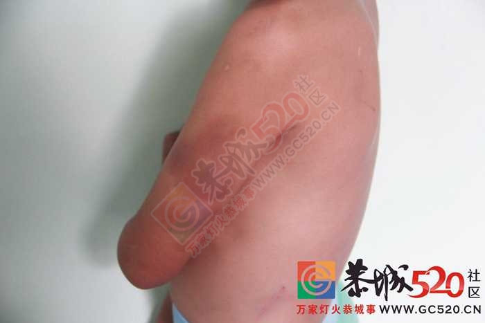 惊爆！恭城江南双语实验学校（地址：在原党校）学生被群殴！家长讨公道无果！640 / 作者:520小编 / 帖子ID:116807