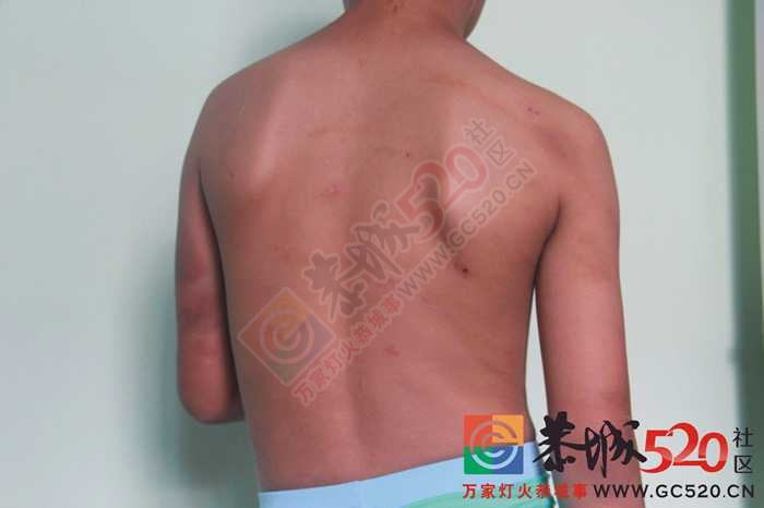 惊爆！恭城江南双语实验学校（地址：在原党校）学生被群殴！家长讨公道无果！535 / 作者:520小编 / 帖子ID:116807
