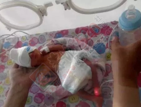 齐市一母亲怀孕28周生下巴掌女婴，一天停止呼吸三四次，仍在生死关上挣扎……644 / 作者:渲染人生 / 帖子ID:160229