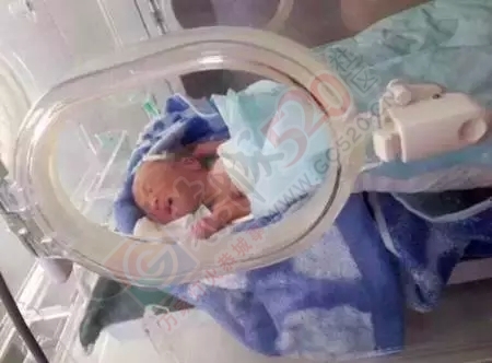 齐市一母亲怀孕28周生下巴掌女婴，一天停止呼吸三四次，仍在生死关上挣扎……48 / 作者:渲染人生 / 帖子ID:160229
