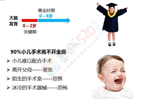 手术要全~麻？真的吗？不会影响大脑吧？293 / 作者:健康小天使 / 帖子ID:160456