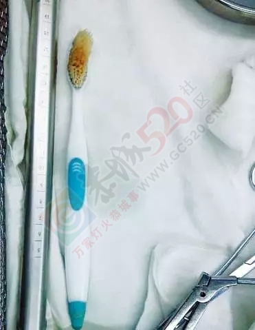 天啦撸，广西90后妹子刷牙时把牙刷整个吞进肚，她是如何做到的？450 / 作者:额外听歌 / 帖子ID:160710