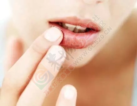 终于找到嘴唇老是干裂的原因了！当然不是因为缺水……354 / 作者:人艰不拆 / 帖子ID:161287