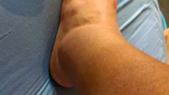 终于找到嘴唇老是干裂的原因了！当然不是因为缺水……173 / 作者:人艰不拆 / 帖子ID:161287