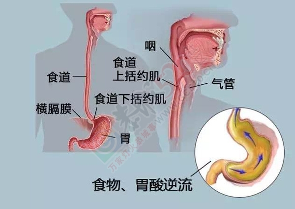 哮喘老不好？可能是胃病！821 / 作者:健康小天使 / 帖子ID:162248