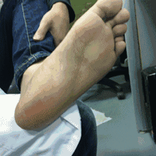 “十人九湿”，万病皆始于湿！找准5个穴位每天按摩1分钟，有奇效！679 / 作者:人艰不拆 / 帖子ID:163594