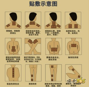 纯中药治疗骨病，骨病的克星656 / 作者:黄哥佬 / 帖子ID:172567