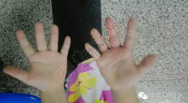 带小孩去恭城新体育场散步的家长，一定要注意啦！防不胜防呀！650 / 作者:千变万幻 / 帖子ID:175938