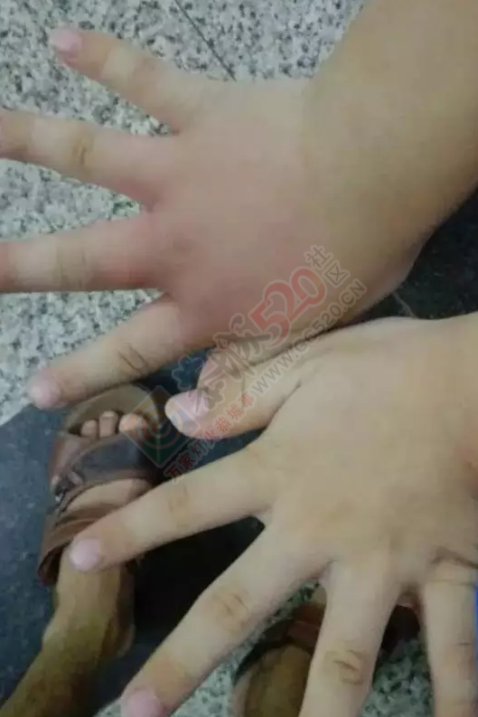 带小孩去恭城新体育场散步的家长，一定要注意啦！防不胜防呀！445 / 作者:千变万幻 / 帖子ID:175938