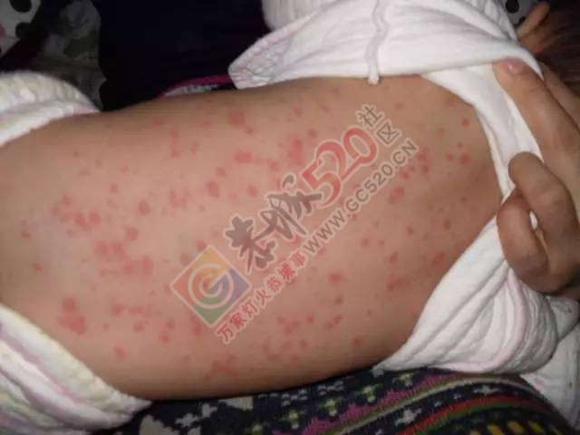 凉席一年没用，掀开后夸张成这样！恭城人都看看吧631 / 作者:jphzy / 帖子ID:231975