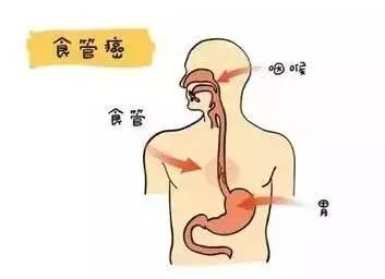 喝水喝出食管癌！这个习惯你一定有330 / 作者:疾控客服 / 帖子ID:235162