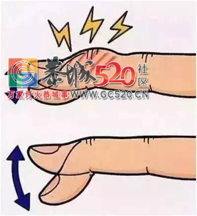 震惊！关节“咔咔”响是疾病预告？143 / 作者:疾控客服 / 帖子ID:235163