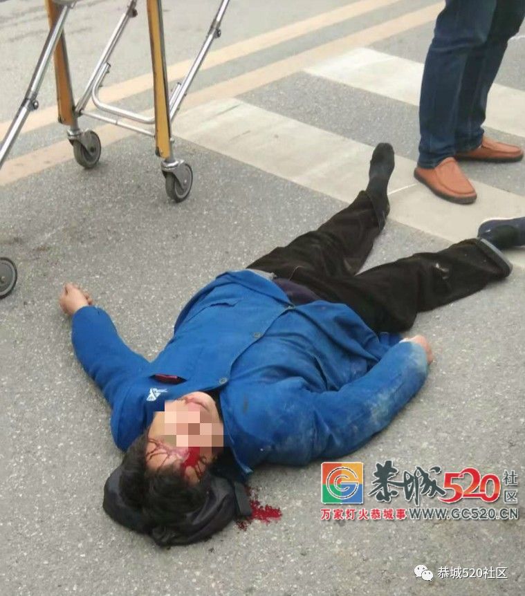 突发！莲花高中路段一大排量摩托车与电动车相撞，电动车司机受伤流血521 / 作者:看清所以看轻 / 帖子ID:266531