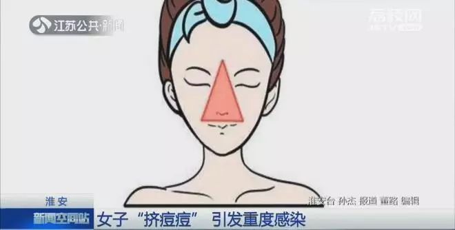 挤了颗痘痘，高烧昏迷进ICU！别再手欠了啊啊啊啊612 / 作者:单身汉子 / 帖子ID:267748