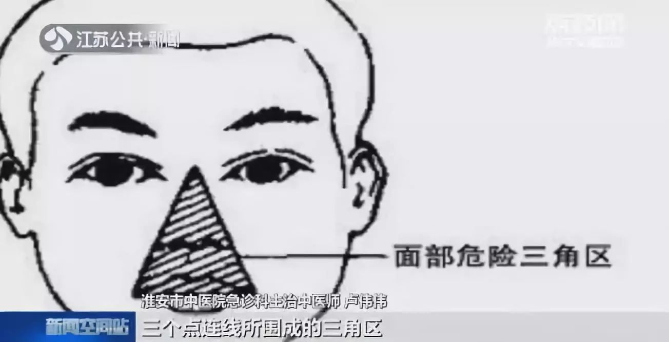 挤了颗痘痘，高烧昏迷进ICU！别再手欠了啊啊啊啊58 / 作者:单身汉子 / 帖子ID:267748