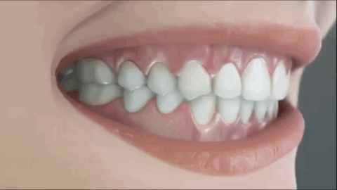 刷牙、漱口、用牙线……到底如何保护牙齿？协和医生权威解答558 / 作者:给点阳光就灿烂 / 帖子ID:269151