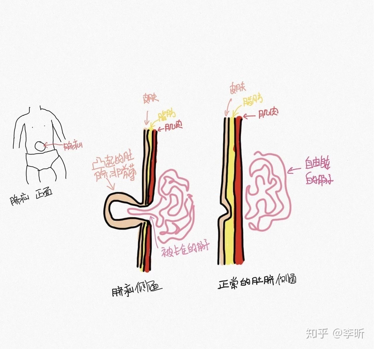 我听过最糟糕的育儿建议：他还是个孩子711 / 作者:kevinbe888 / 帖子ID:272262