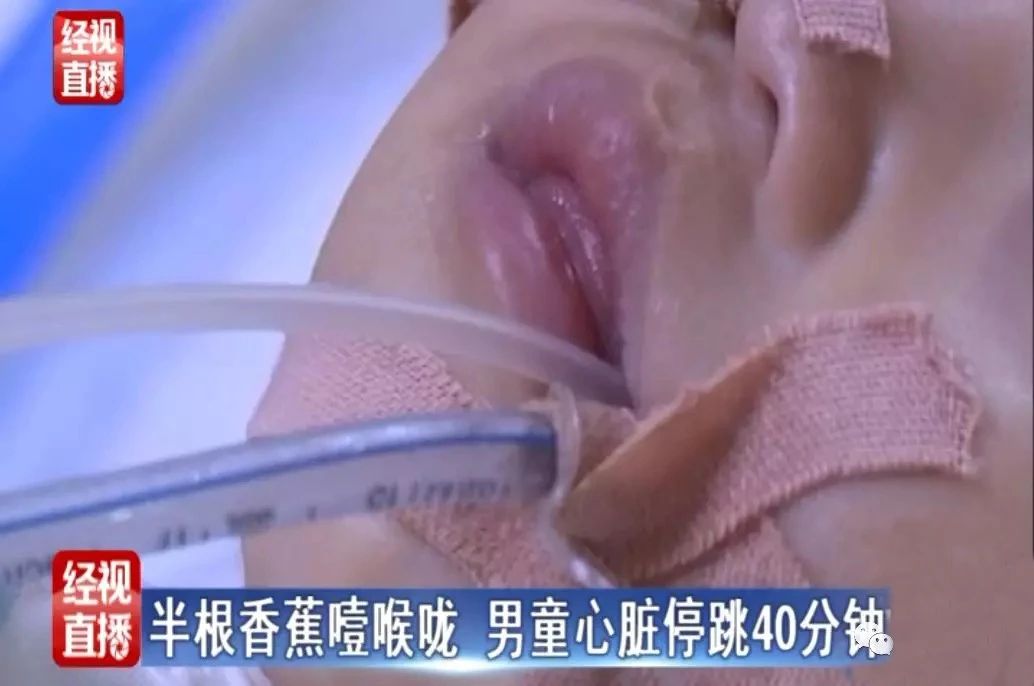 男童吃香蕉心脏停止半小时，别让你的无知，将孩子推向深渊！711 / 作者:YKJNzVqH / 帖子ID:273121
