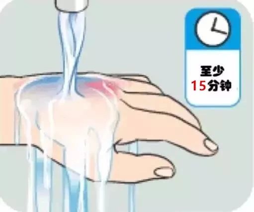 可怕！20分钟眼球被溶化！8岁男孩终生失明！244 / 作者:kevinbe888 / 帖子ID:274146