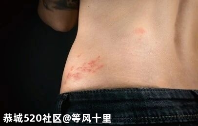 比生孩子还痛！一种老年常见病，可能正在折磨你的父母572 / 作者:等风十里 / 帖子ID:276387