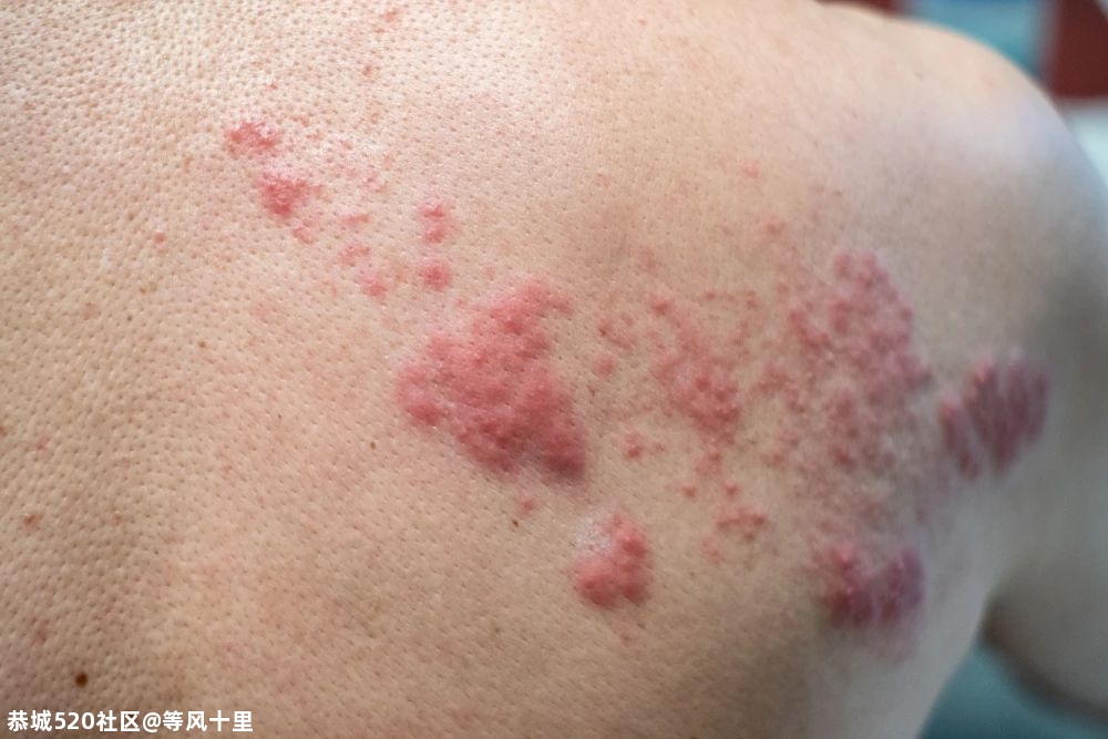 比生孩子还痛！一种老年常见病，可能正在折磨你的父母970 / 作者:等风十里 / 帖子ID:276387