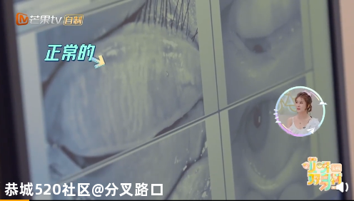 “30岁的杨迪50岁的眼睛，有点吓人！”这个热搜吓坏网友：不能再天天做这事407 / 作者:分叉路口 / 帖子ID:277173
