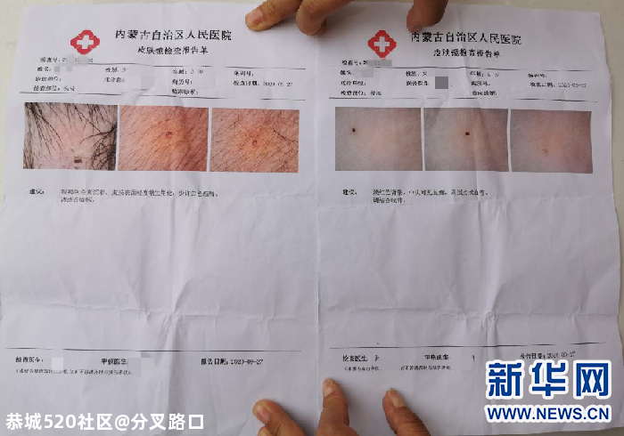 一幼儿园多名孩子身上现不明针眼！3名教师被刑拘！658 / 作者:分叉路口 / 帖子ID:277585