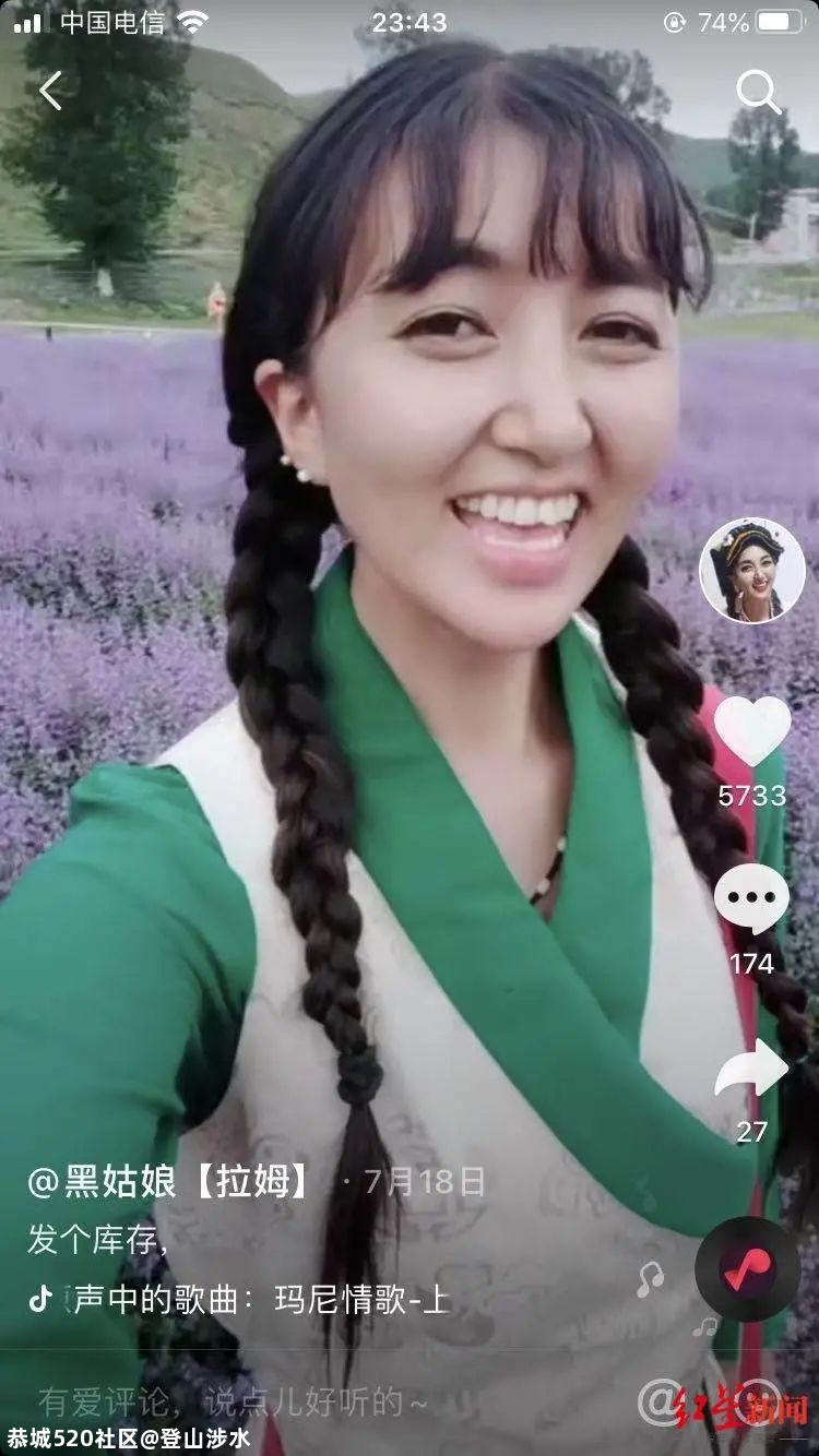 痛心！被前夫烧伤的网红拉姆离世932 / 作者:登山涉水 / 帖子ID:277686
