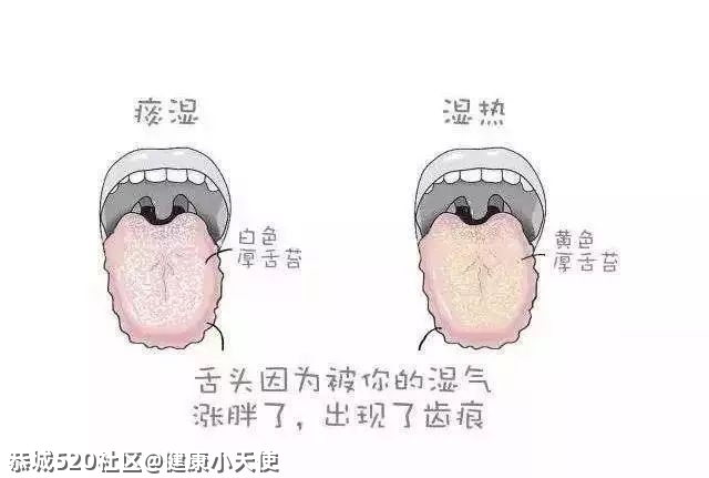 感觉自己体内湿气重？这些东西每天吃一点，帮你排出体内湿毒~525 / 作者:健康小天使 / 帖子ID:284885