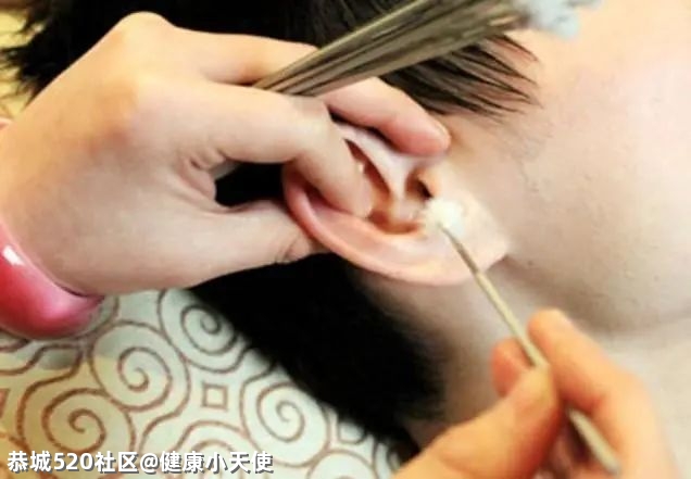 采耳撩出“蘑菇”？恭城人要小心！708 / 作者:健康小天使 / 帖子ID:284998