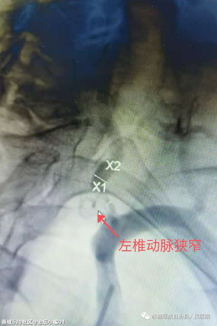 小针口大疗效，必要时可救命〡恭城只有这里能做，别不知道！393 / 作者:论坛小编01 / 帖子ID:286048