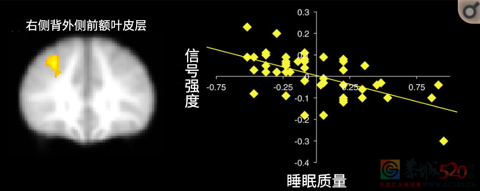 熬夜后补一觉就行？看完你就不这么想了……462 / 作者:健康小天使 / 帖子ID:288149