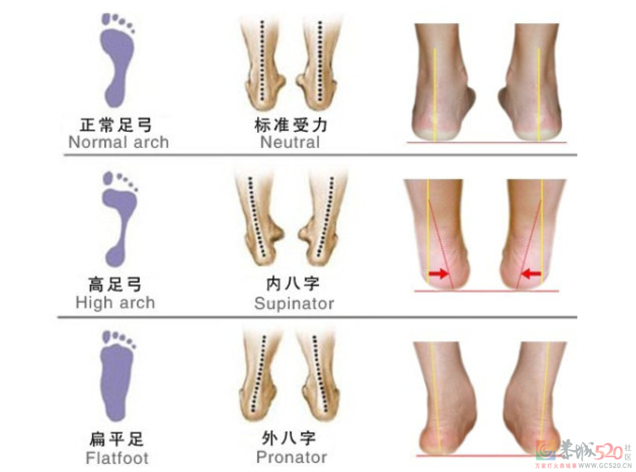 人到中年，足弓就渐渐“塌”了！一个脚印看出足弓高低575 / 作者:健康小天使 / 帖子ID:288814