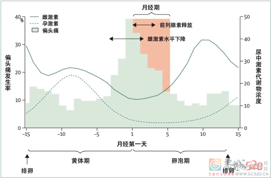 导致女性偏头痛的重要原因，终于找到了（不是压力和熬夜）50 / 作者:健康小天使 / 帖子ID:290071