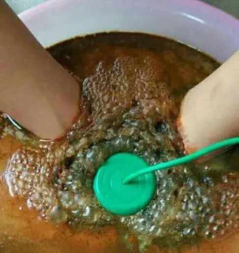 早就淘汰的垃圾，成为买回家的保健品97 / 作者:健康小天使 / 帖子ID:292019