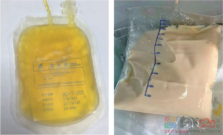 甘油三酯的危险被低估了，超过这个值就该用药688 / 作者:健康小天使 / 帖子ID:294329