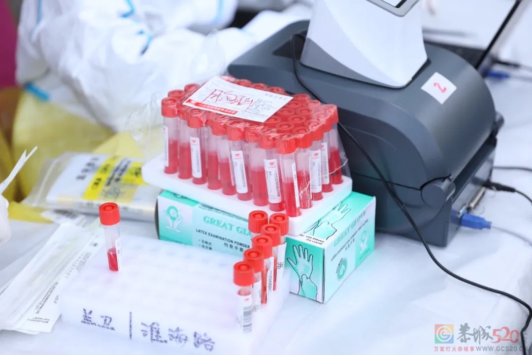 新冠阳性康复后，我经历了什么？168 / 作者:儿时的回忆 / 帖子ID:297814