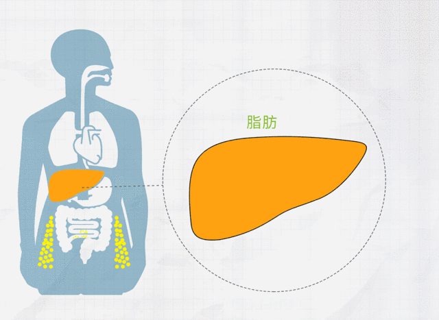 当「含脂量」5%、10%、25%时，你的肝脏会发生什么？32 / 作者:健康小天使 / 帖子ID:297848