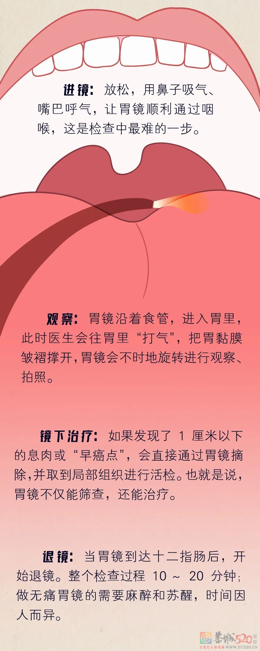 沉浸式体验：做「胃肠镜检查」全过程109 / 作者:健康小天使 / 帖子ID:297978